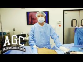 bichectomy clinics in austin Austin Gynecomastia Center