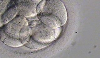 sperm analysis austin Ovation Fertility South Austin - Andrology